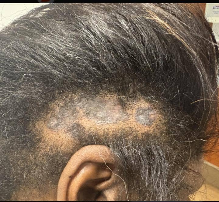 Esthétique : Comment les produits défrisants peuvent être dangereux pour les cheveux ?